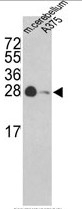 AP17847PU-N - 14-3-3 protein gamma