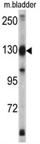 AP17839PU-N - XPO1 / Exportin-1