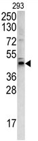 AP17835PU-N - WNT4