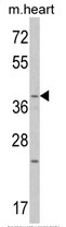 AP17833PU-N - WNT1