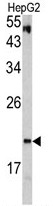 AP17826PU-N - VHL