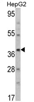 AP17103PU-N - Aminomethyltransferase