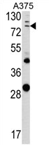 AP17109PU-N - Annexin A1 / ANXA1