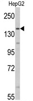AP17115PU-N - Aldehyde oxidase