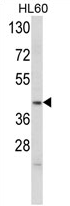 AP17119PU-N - Apolipoprotein L4 / ApoL4