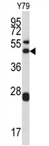 AP17130PU-N - ARPC1A / SOP2L