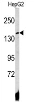 AP17142PU-N - ATP7B