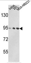 AP17823PU-N - TER ATPase / VCP