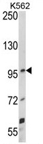 AP17822PU-N - UNC5C