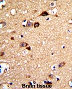 AP17822PU-N - UNC5C