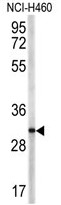 AP17806PU-N - CD154 / CD40L