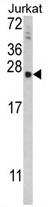 AP17805PU-N - TPT1 / TCTP