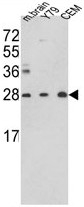 AP17804PU-N - Triosephosphate isomerase (TPI1)