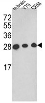 AP17803PU-N - Triosephosphate isomerase (TPI1)