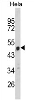 AP17161PU-N - C9orf156 / NAP1