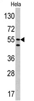 AP17162PU-N - Carbonic anhydrase 9