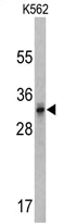 AP17163PU-N - CACNG5