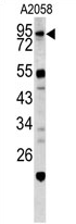 AP17164PU-N - Caldesmon