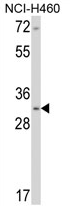AP17167PU-N - Calponin-1