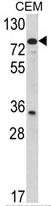 AP17785PU-N - Transglutaminase-4 (TGM4)