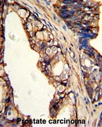 AP17785PU-N - Transglutaminase-4 (TGM4)