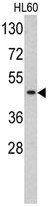 AP17778PU-N - TBP (TATA-box-binding protein)
