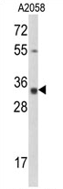 AP17171PU-N - Calponin-3
