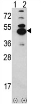 AP17173PU-N - CAMK1D
