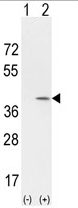 AP17192PU-N - Cyclin D1