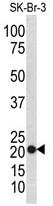 AP17774PU-N - Transgelin (TAGLN)