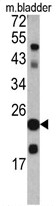 AP17773PU-N - Transgelin (TAGLN)