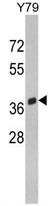 AP17759PU-N - SPARC / Osteonectin