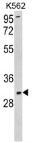 AP17757PU-N - Superoxide Dismutase 3 / SOD3
