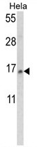 AP17756PU-N - snRNP-D2 / Sm-D2