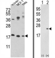 AP17209PU-N - Cofilin-1