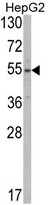 AP17749PU-N - SLC38A3