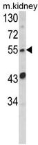 AP17745PU-N - SIL1 / BAP