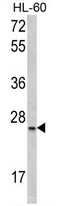 AP17742PU-N - SFRS1 (SF2)