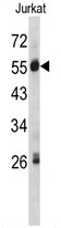 AP17738PU-N - SERPING1 / C1 Inhibitor
