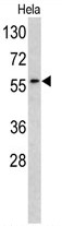 AP17727PU-N - Tyrosine-protein kinase RYK