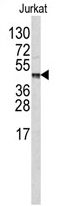 AP17235PU-N - Carboxypeptidase B2
