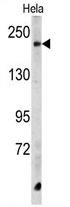 AP17236PU-N - Carboxypeptidase D