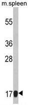 AP17722PU-N - RPS18