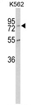 AP17239PU-N - Carboxypeptidase Z