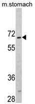 AP17243PU-N - CREB3L1 / OASIS