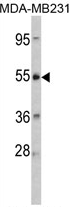 AP17244PU-N - CRHR2