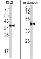 AP17256PU-N - Cathepsin E