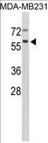 AP17257PU-N - Cathepsin F