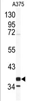 AP17260PU-N - Cathepsin K