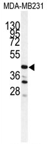 AP17262PU-N - Cathepsin S